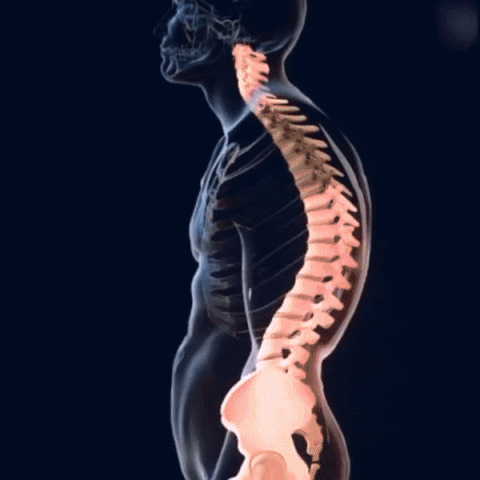 Corrector de Postura