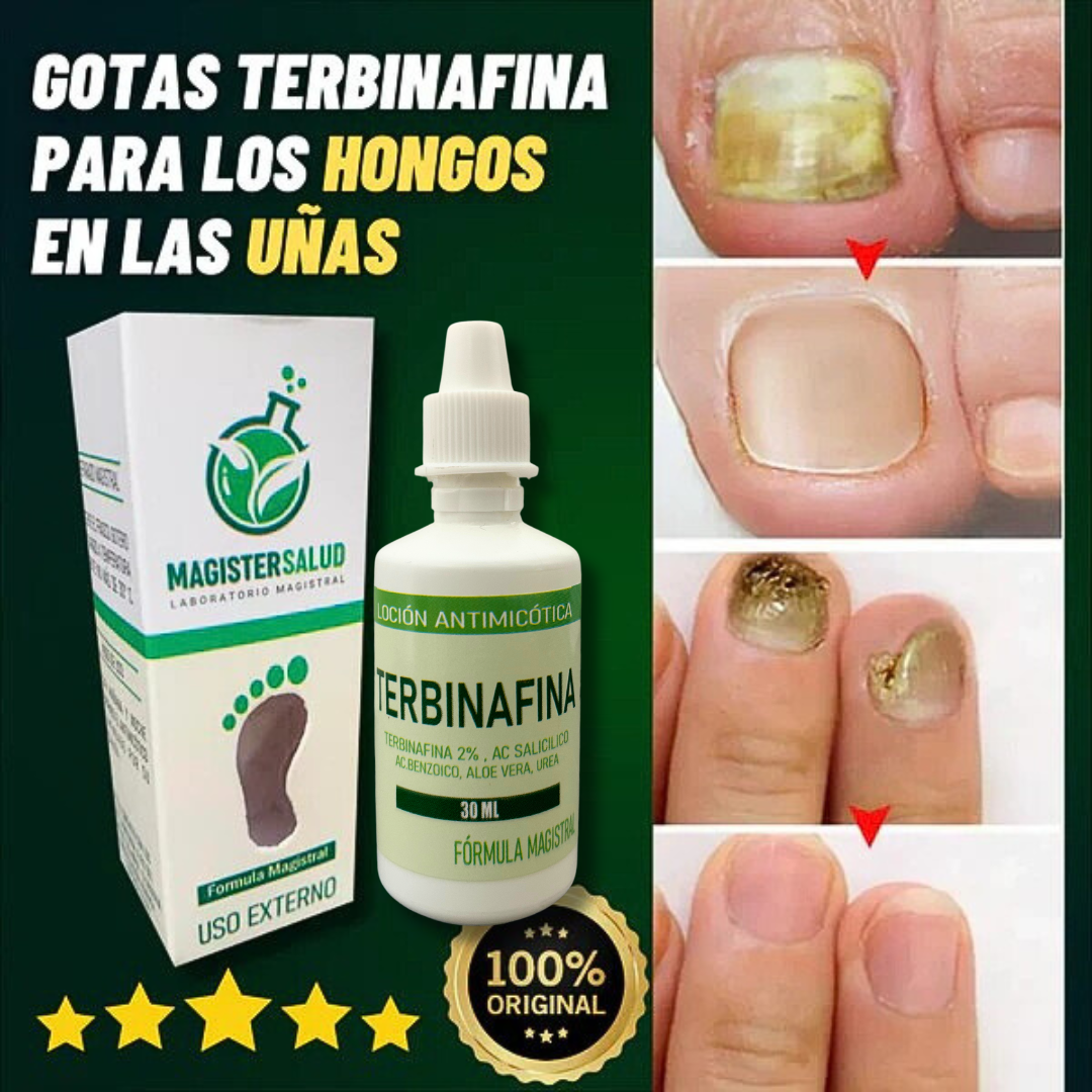 GOTAS DE TERBINAFINA PARA LOS HONGOS EN LAS UÑAS Y PIES