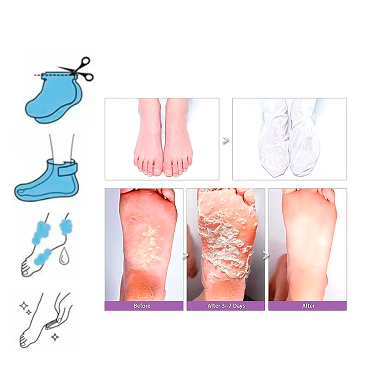 Mascarilla Exfoliante para Pies- ELIMINA PIEL MUERTA Y CALLOS