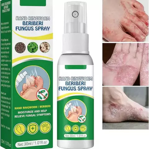 GOTAS DE TERBINAFINA ANTI-HONGO para uñas y pie