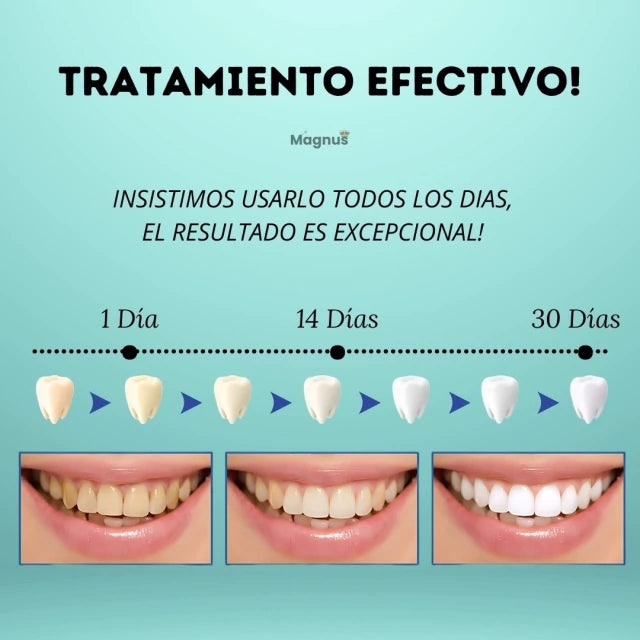 Lápiz Blanqueador Dental White 2 x 1 - Magnus™