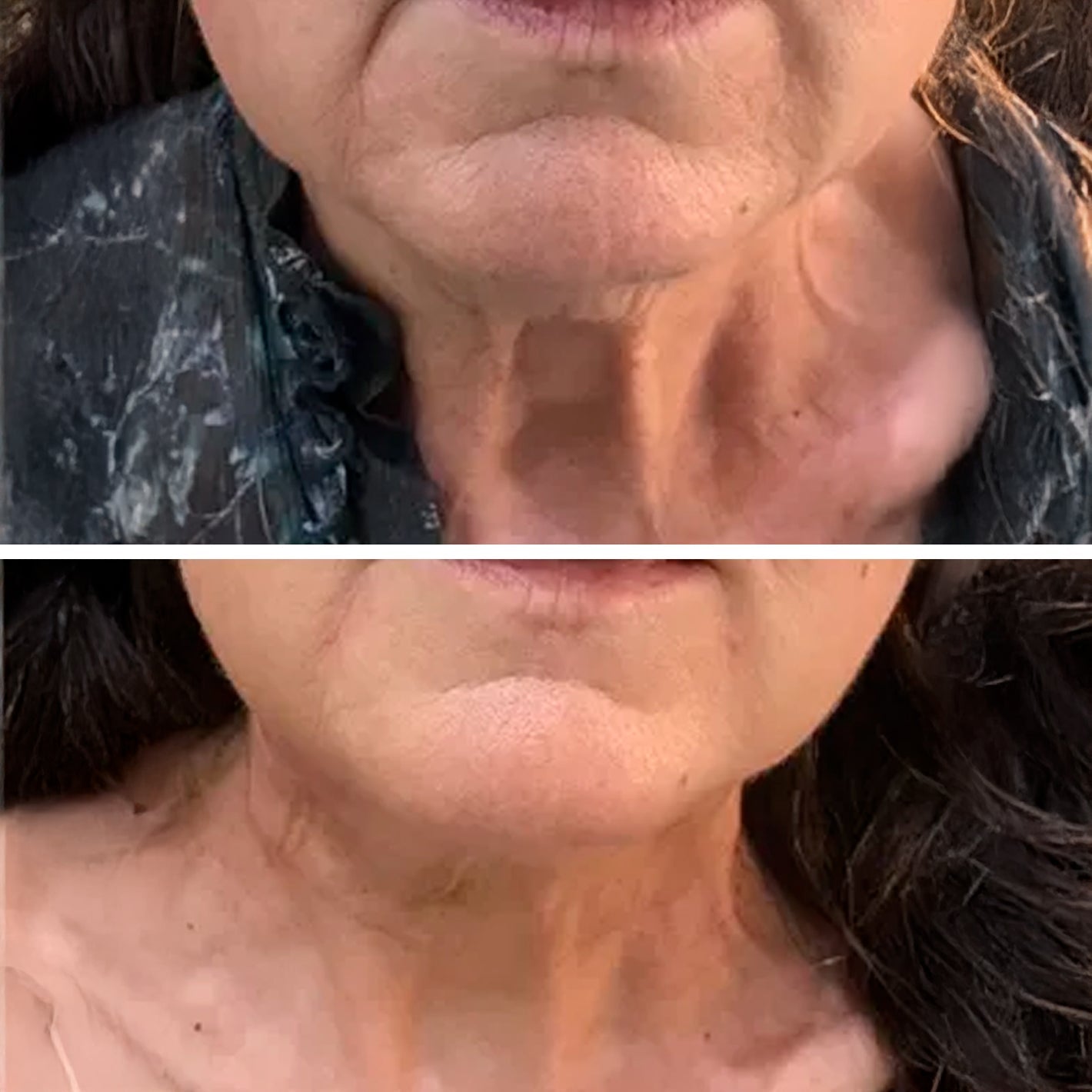 MASCARILLA DE ORO ANTIEDAD.