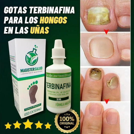 GOTAS DE TERBINAFINA PARA LOS HONGOS EN LAS UÑAS Y PIES