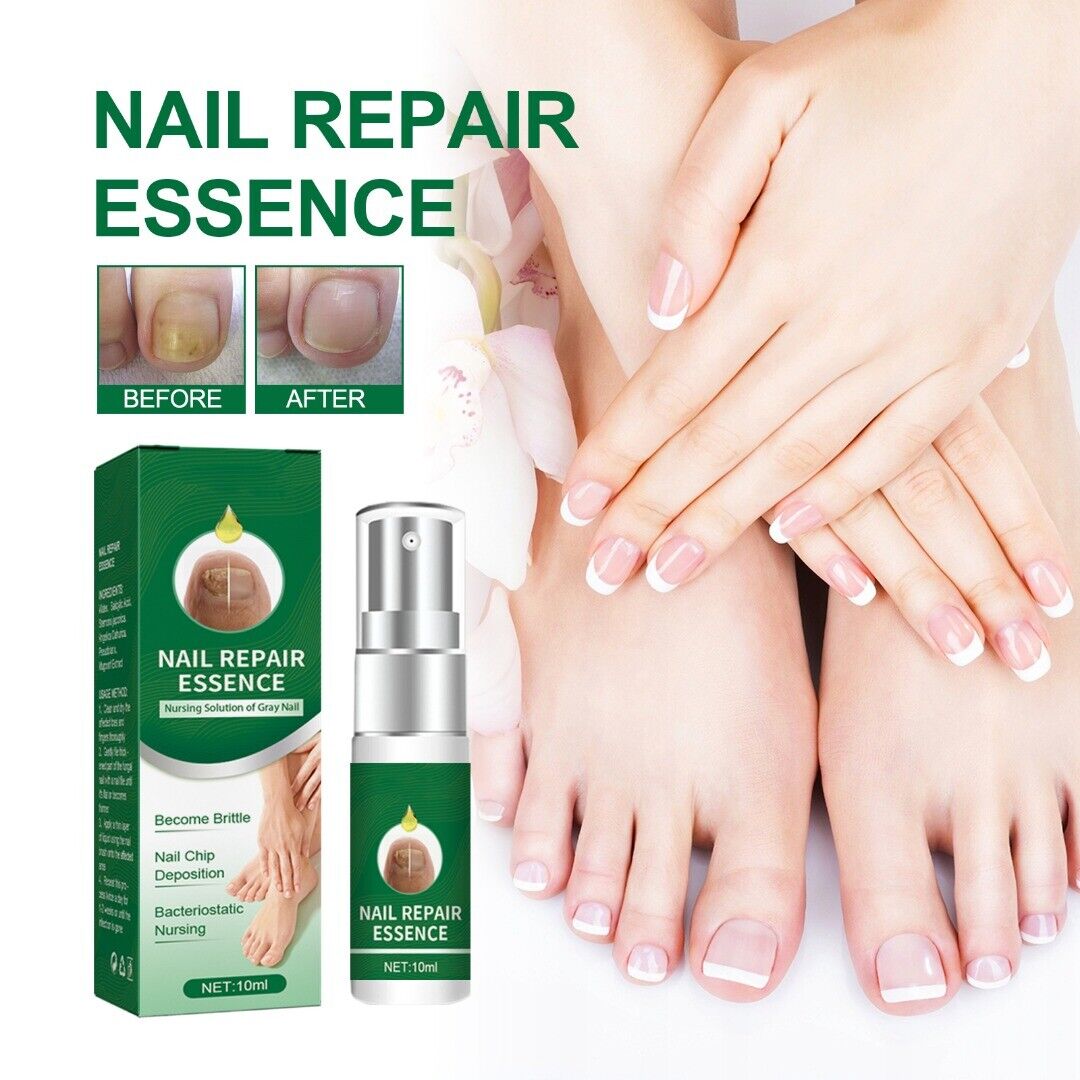 Suero para uñas con veneno de abeja-crecimiento y elimina hongos en 10 dias