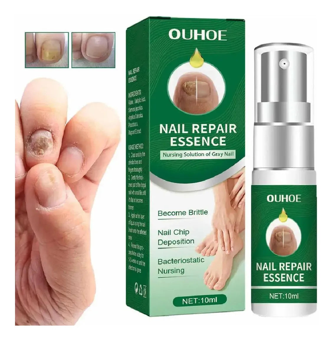 Suero para uñas con veneno de abeja-crecimiento y elimina hongos en 10 dias