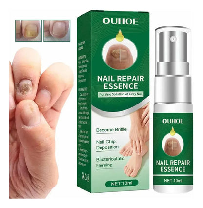 Suero para uñas con veneno de abeja-crecimiento y elimina hongos en 10 dias