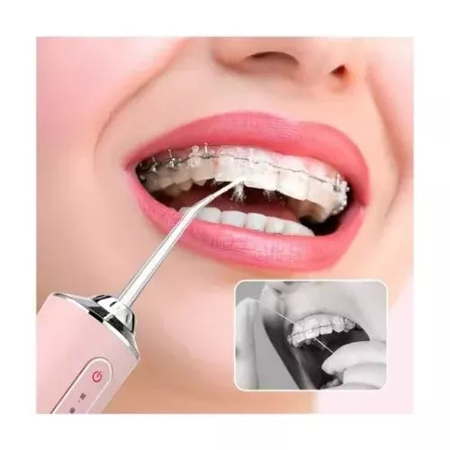 💧 Irrigador Bucal Portátil de Dientes 🦷 Limpieza Profunda y Sonrisa Saludable