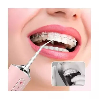 💧 Irrigador Bucal Portátil de Dientes 🦷 Limpieza Profunda y Sonrisa Saludable