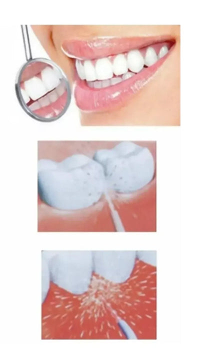 💧 Irrigador Bucal Portátil de Dientes 🦷 Limpieza Profunda y Sonrisa Saludable